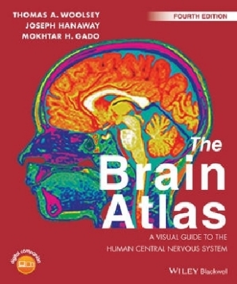 The Brain Atlas - Thomas A. Woolsey, Joseph Hanaway, Mokhtar H. Gado, Joel C. Geerling