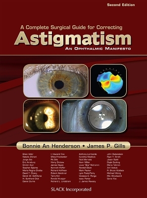 A Complete Surgical Guide for Correcting Astigmatism - Bonnie An Henderson; James Gills