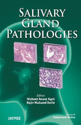 Salivary Gland Pathologies - Nisheet Anant Agni; Rajiv Mukund Borle