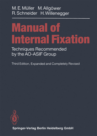 Manual of INTERNAL FIXATION - Maurice E. Müller; Martin Allgöwer; Robert Schneider; Hans Willenegger