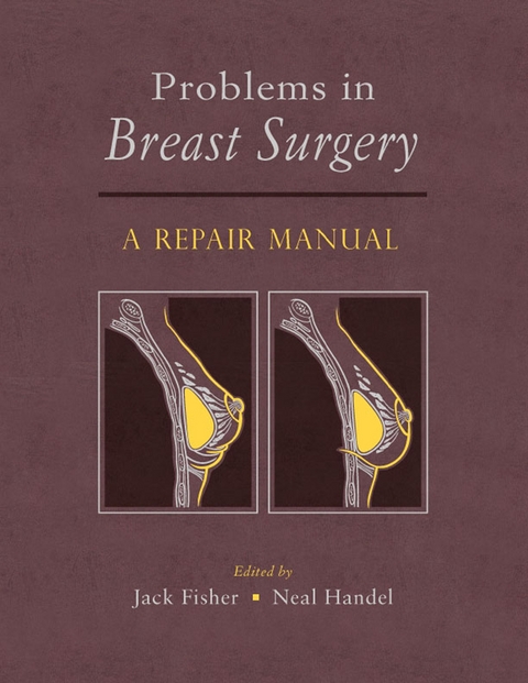Problems in Breast Surgery - 