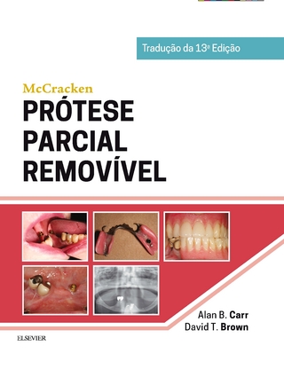 McCracken Protese Parcial Removivel - David T. Brown; Alan B. Carr