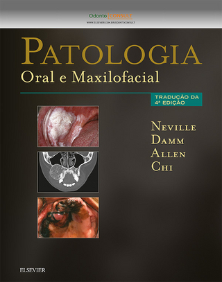 Patologia Oral e Maxilofacial - Brad Neville