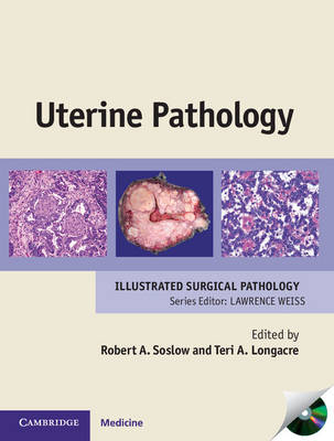 Uterine Pathology - Robert A. Soslow; Teri A. Longacre