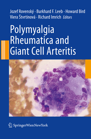 Polymyalgia Rheumatica and Giant Cell Arteritis - Jozef Rovensky; Burkhard F. Leeb; Howard Bird; Viera ?tvrtinová; Richard Imrich