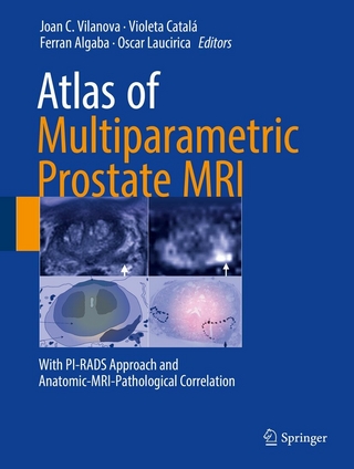 Atlas of Multiparametric Prostate MRI - Joan C. Vilanova; Violeta Catalá; Ferran Algaba; Oscar Laucirica