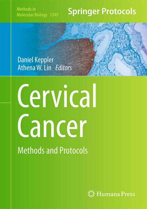 Cervical Cancer - 