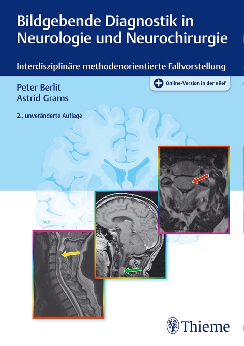 Bildgebende Diagnostik in Neurologie und Neurochirurgie - Peter-Dirk Berlit, Astrid E. Grams