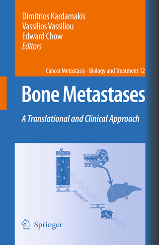 Bone Metastases - Dimitrios Kardamakis; Vassilios Vassiliou; Edward Chow