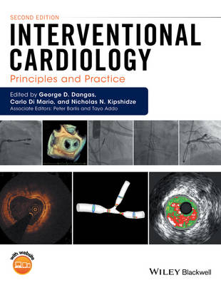 Interventional Cardiology - 