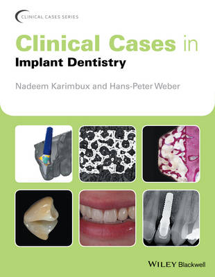 Clinical Cases in Implant Dentistry - 