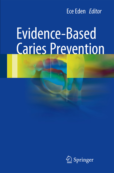 Evidence-Based Caries Prevention - 