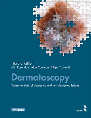 Dermatoscopy - Harald Kittler; Cliff Rosendahl; Alan Cameron; Philipp Tschandl
