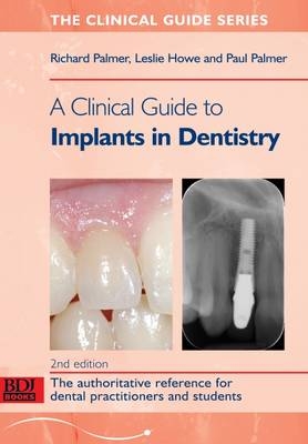 A Clinical Guide to Implants in Dentistry - Richard Palmer, Howe Leslie, Paul Palmer