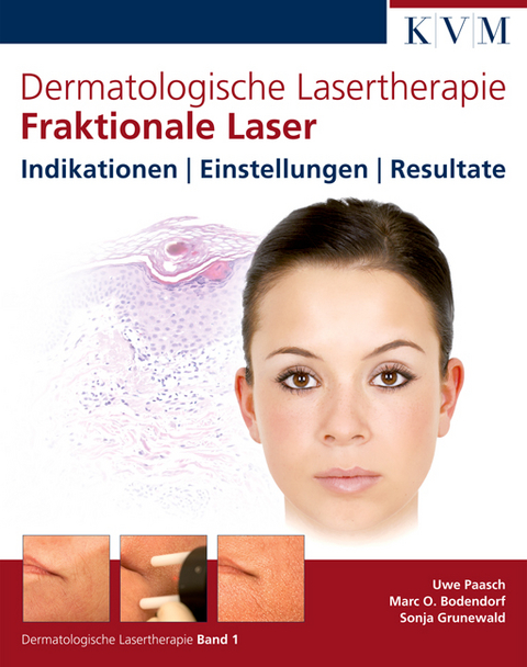 Dermatologische Lasertherapie Band 1: Fraktionale Laser - Uwe Paasch, Marc Bodendorf, Sonja Grunewald