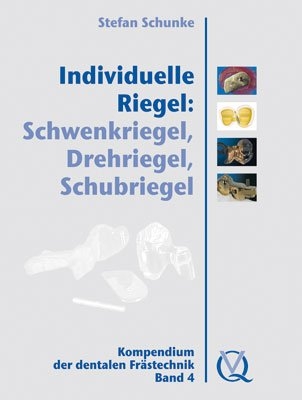 Individuelle Riegel: Schwenkriegel, Drehriegel, Schubriegel   - Stefan Schunke