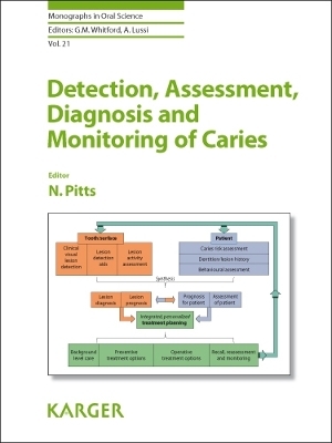 Detection, Assessment, Diagnosis and Monitoring of Caries - 