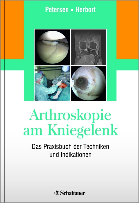 Arthroskopie am Kniegelenk - Wolf Petersen, Mirco Herbort