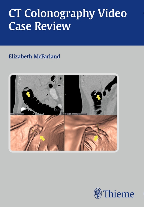 CT Colonography Video Case Review - Elizabeth McFarland