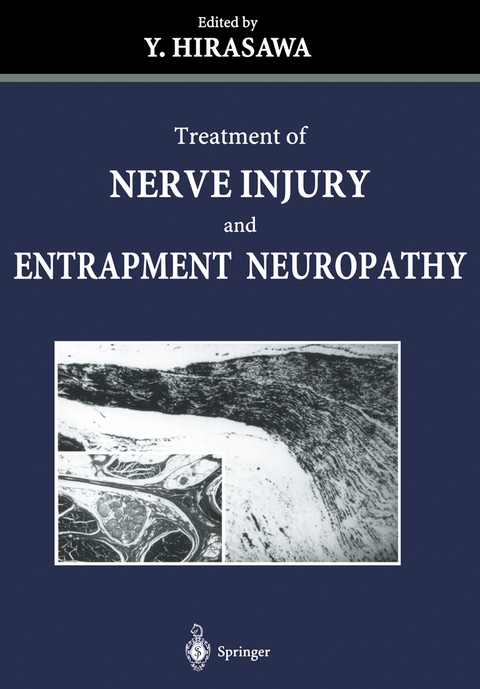 Treatment of Nerve Injury and Entrapment Neuropathy - 