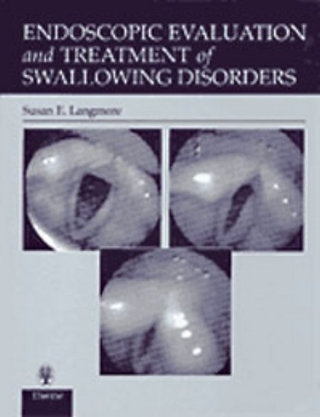 Endoscopic Evaluation and Treatment of Swallowing Disorders - Susan E. Langmore