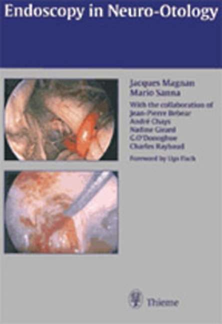 Endoscopy in Neuro-Otology and Skull Base Surgery (AT) - Jacques Magnan, MD Magnan  Jacques, Mario Sanna