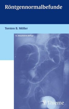 Röntgennormalbefunde - Torsten B Möller