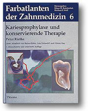 Band 6: Kariesprophylaxe und konservierende Therapie - Peter Riethe