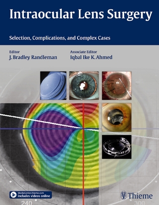 Intraocular Lens Surgery - Bradley Randleman; Iqbal Ike K Ahmed