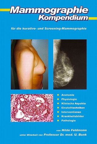 Mammographie-Kompendium für die kurative- und Screening-Mammographie - Hilde Feldmann