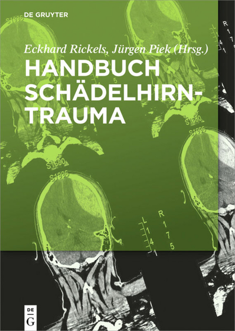 Handbuch Schädelhirntrauma - 
