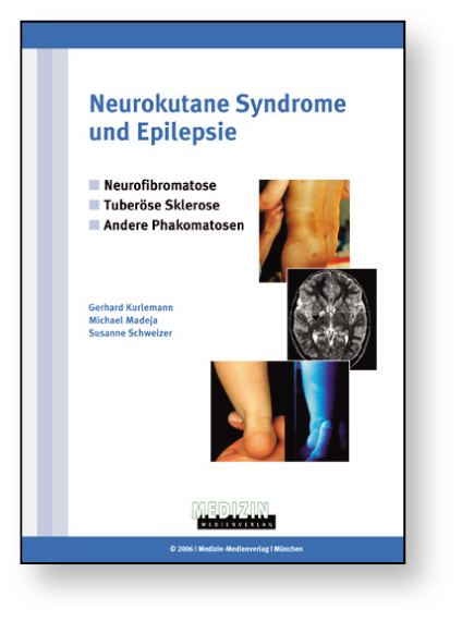 Neurokutane Syndrome und Epilepsie - Gerhard Kurlemann, Michael Madeja, Susanne Schweizer
