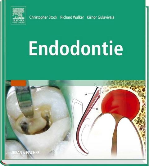 Endodontie - 