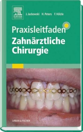 Praxisleitfaden Zahnärztliche Chirurgie - Jochen Jackowski, Hajo Peters, Frank Hölzle