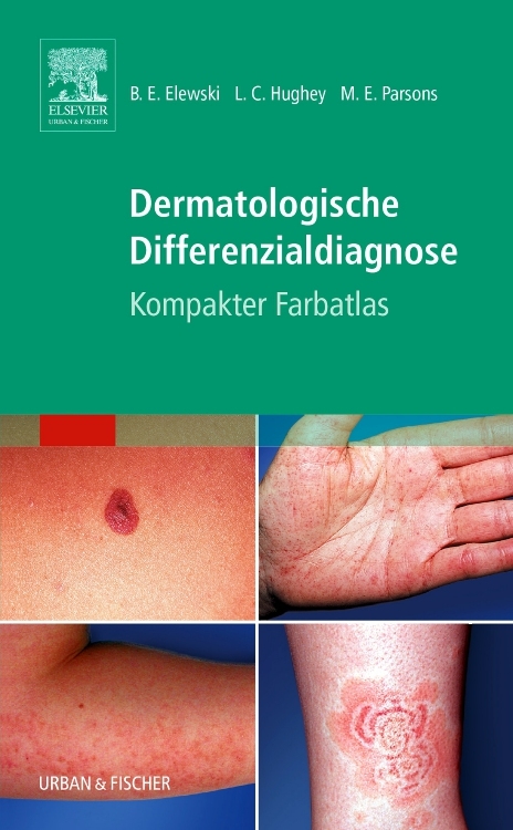 Dermatologische Differenzialdiagnose - 