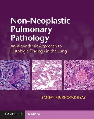 Non-Neoplastic Pulmonary Pathology with Online Resource - Sanjay Mukhopadhyay
