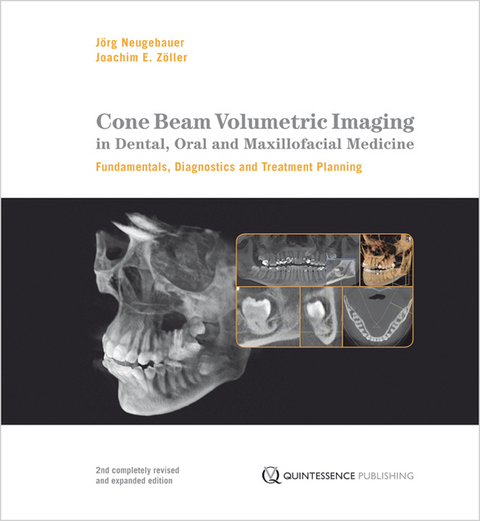 Cone Beam Volumetric Imaging in Dental, Oral and Maxillofacial Medicine - Jorg Neugebauer, Joachim Zoller
