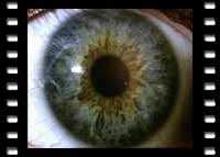 Weiterbildung in der Augen-(Iris)diagnose - Klaus H Bayer