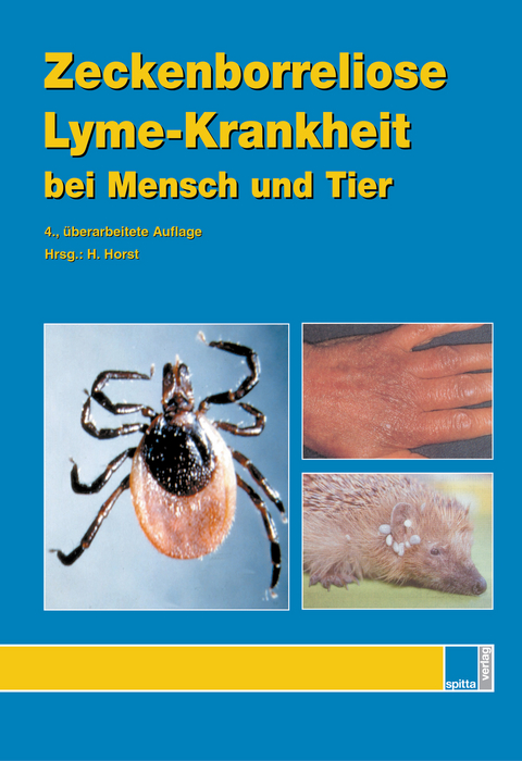 Zeckenborreliose – Lyme-Krankheit bei Mensch und Tier - Hans Horst, Arndt Liebisch