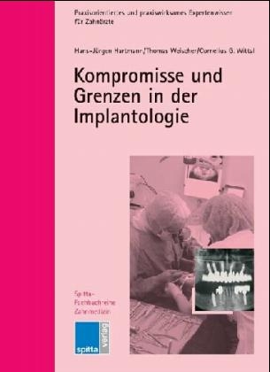 Kompromisse und Grenzen in der Implantologie - Hans J Hartmann, Thomas Weischer, Cornelius Wittal
