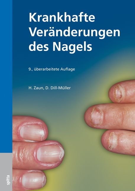 Krankhafte Veränderungen des Nagels - Hans O Zaun, Dorothee Dill-Müller
