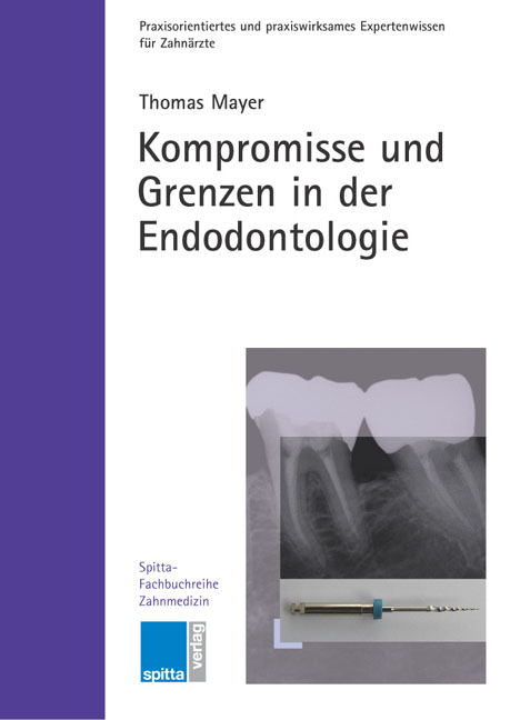 Kompromisse und Grenzen in der Endodontologie - Thomas Mayer