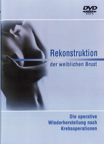 Rekonstruktion der weiblichen Brust - Reinhold Keiner