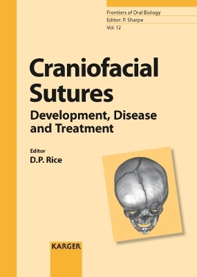Craniofacial Sutures - 