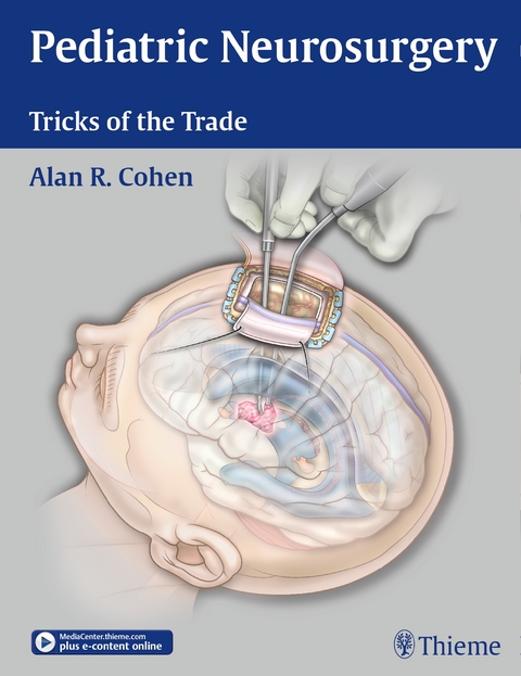 Pediatric Neurosurgery: Tricks of the Trade - Alan R. Cohen