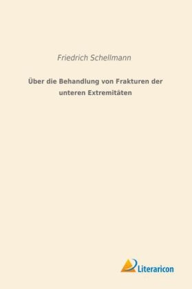 Über die Behandlung von Frakturen der unteren Extremitäten - Friedrich Schellmann