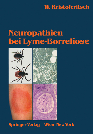Neuropathien bei Lyme-Borreliose - Wolfgang Kristoferitsch