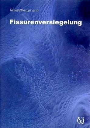 Fissurenversiegelung, 1 DVD - Herbert Rukat,  Bergmann
