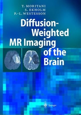 Diffusion-Weighted MR Imaging of the Brain - Toshio Moritani, Sven Ekholm, P. L. Westesson