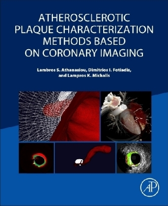 Atherosclerotic Plaque Characterization Methods Based on Coronary Imaging -  Lambros S Athanasiou,  Dimitrios I Fotiadis,  Lampros K Michalis